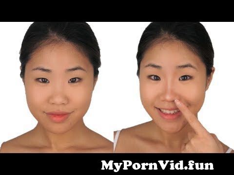 Porn Asian Plastic Surgery