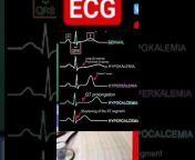 echocardiography test nicl