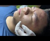 Spa Linh Mun Acne Treatment
