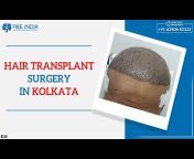 Fue India Hair Transplant