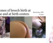 This 1-hour lecture covers the evidence on outcomes of community breech birth (home or birth center). Presented by Rixa Freeze, PhD of Breech Without Borders (breechwithoutborders.org).
