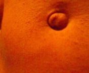 weird belly button tick