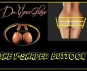 We are going to talk about how the V shape is the most surgically challenging of the different shapes. Again, let’s look at the diagram. I will draw a line on top of the buttocks, one at the middle, and one on the bottom. Connect these three lines, and we can see that a V shape is formed. In order for you to understand why the V-shaped buttock is such a difficult shape to fix, let’s say, for example, that I want to change a V shape into an A shape or hourglass shape; these are the two shapes