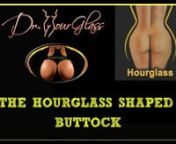 We have previously described the A shape, the V shape, the square shape, and the round buttock. The last buttock shape that I would like to discuss is the hourglass-shaped buttock. If we compare the round-shaped buttock and the hourglass-shaped buttock side-by-side, you will notice that they are very similar. The problem is that the round buttock has an abnormal transverse dimension that makes it look very unnatural and aesthetically unpleasant. If you look at the diagram of an hourglass buttock