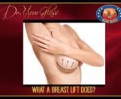 A breast lift is a procedure to, from a surgeon&#39;s standpoint, lift the nipple-areolar complex to the right anatomical position. As a surgeon, before performing a breast lift, I mark the area where the nipple is supposed to be and measure the distance to where the nipple is at the moment. Using this measurement, I then lift the nipple and areola to the right anatomical place.nnThe breast lift by itself will lift your breast tissue, but will also make your breast smaller. So, before having your br