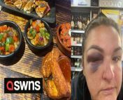 A gran ended up with a massive swollen face and concussion after she face-planted in the loos at a bottomless brunch.Nat Cooper, 43, even wore sensible flat sandals for the meal at Chapo&#39;s El Campeon in Ashton, Makerfield, last Saturday [11], for her birthday.But after two &#39;big big&#39; vodkas and a can of Lambrini on the bus, Nat and her friend Siobhan arrived at the restaurant and immediately hit the cocktails and bottomless prosecco.During the two hour sitting which cost the pair £35 each, Nat drank countless Porn Star Martinis and glasses of prosecco which ultimately led to a visit to the bathroom where it all went wrong.After sitting on the toilet with the cubicle door open so she could carry on chatting, Nat fell face first to the floor, smacking her eye hard.The poor grandmother-of-one was picked up by Siobhan and believes she had a concussion as she doesn&#39;t remember the fall or journey home.But she has a hugely swollen face as a memento from the boozy accident.Petrol station cashier and mum-of-six Nat, from St Helen&#39;s, Merseyside, said: &#92;