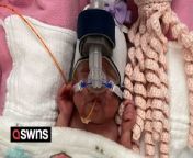 A mum who gave birth to twins 16 weeks early lost her son at 21 days old - while his tiny sister survived after a 101 day fight for her life in hospital. &#60;br/&#62;&#60;br/&#62;Breanna Seibel, 30, and her husband, Chase, 32, an electrician, were &#92;