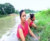 Amazing Net Fishing by Village Lady