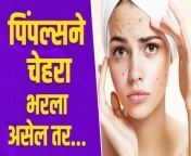 तुमचा पण चेहरा पिंपल्सने भरलाय का? &#124; How To Remove Pimples &#124; Remove Pimples Naturally &#124; Skin Care&#60;br/&#62;#Lokmatsakhi #acne #howtoremoveacne #removepimplesnaturally&#60;br/&#62;&#60;br/&#62;तुमचा पण चेहरा पिंपल्सने भरलाय का?&#60;br/&#62;कितीही उपाय केले तरीही पिंपल्स कमी होत नाहीयेत का? &#60;br/&#62;मग आजचा विडिओ तुमच्यासाठीच आहे..&#60;br/&#62;&#60;br/&#62;&#60;br/&#62;&#60;br/&#62; Disclaimer: The information provided on this channel and its video is for educational purpose only and should not consider as professional advice. We are trying to provide a perfect, valid, specific, detailed information. We are not a licensed professional so make sure with your professional consultant in case you need. All the content published in our channel is our own creativity