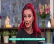 &#60;p&#62;Strictly&#39;s Dianne Buswell opened up about her secret eating disorder that left her not wanting to dance anymore.&#60;/p&#62;&#60;br/&#62;&#60;p&#62;Credit: This Morning / ITV / ITVX&#60;/p&#62;