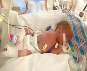 A mum says her baby is thriving despite being born 12 weeks premature - weighing less than a loaf of bread.&#60;br/&#62;&#60;br/&#62;Tiny tot Weston McMahan tipped the scales at just 1lbs 6oz and was rushed to the intensive care unit after his mum underwent an emergency c-section at just 25 weeks.&#60;br/&#62;&#60;br/&#62;After spending the first six weeks of his life in hospital, mum Kaylie McMahan said he has made astonishing progress - is now back on a normal ventilator and she hopes to have him home soon.